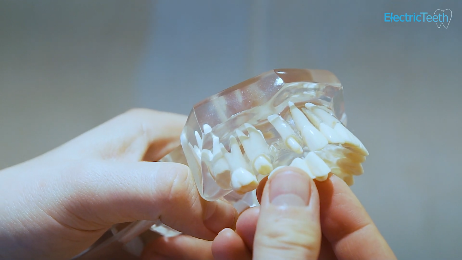 Bridges vs. Partial Dentures: Which is Right for You?