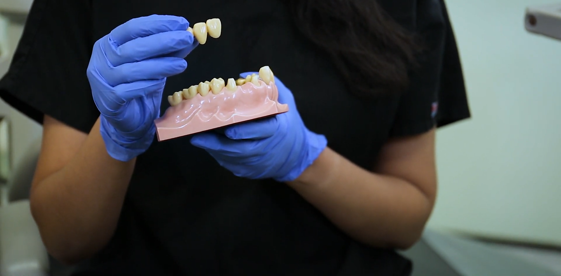 Bridges vs. Partial Dentures: Which is Right for You?