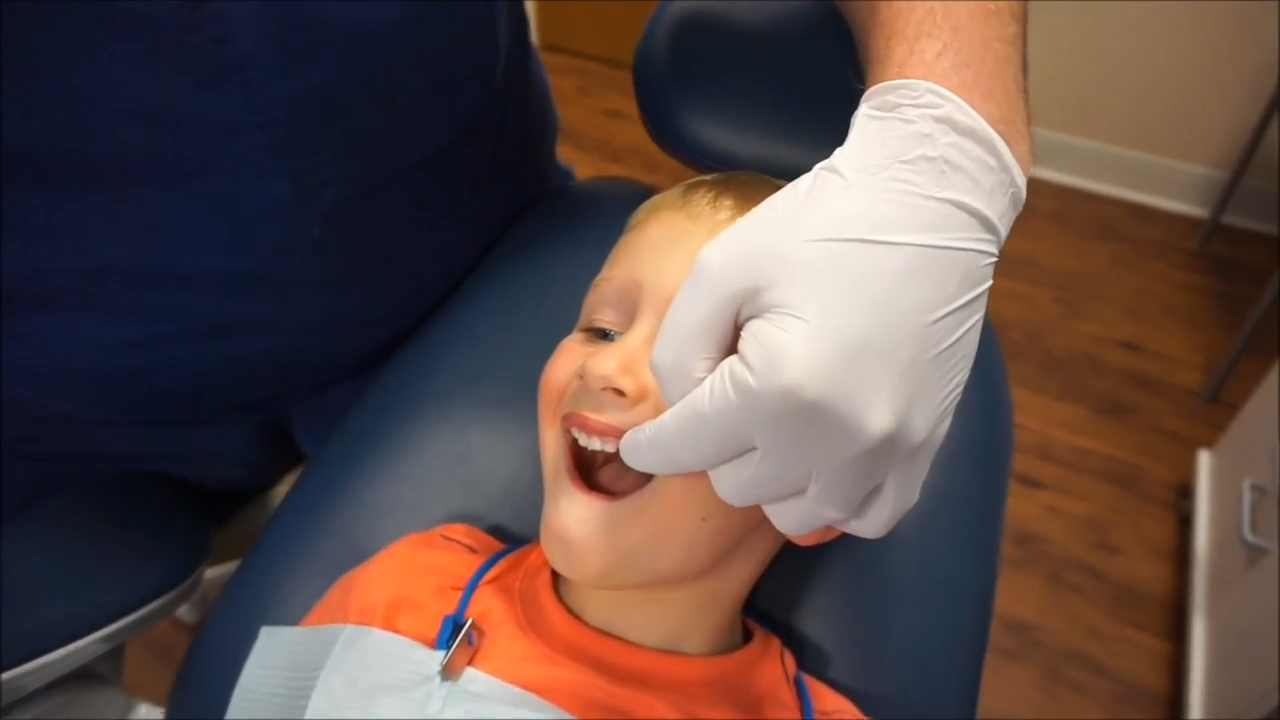 Fluoride Varnish Application proccess