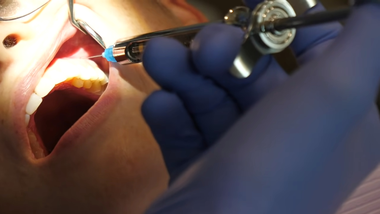 Dentist performing a procedure using a dental instrument on a patient's teeth